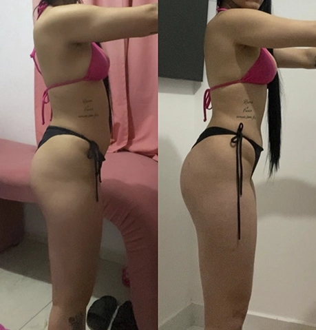 antes e depois 4